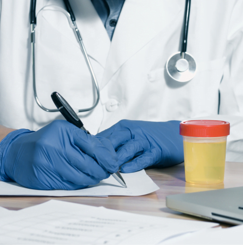 urine-examination-blog
