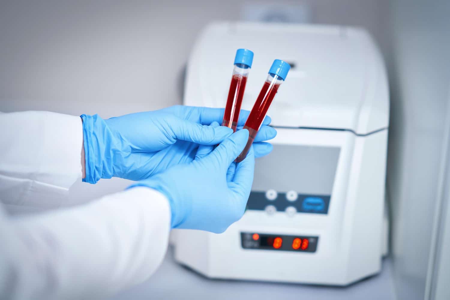 analizator-krwi-1 analizator-krwi-1